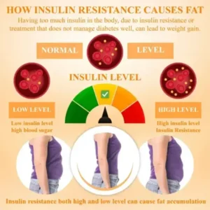 InsuBurn™ LipidFlush BodySlimming Cream