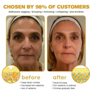 LOVILDS™ Botox Wrinkle Removal Cream