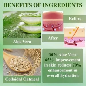 RelievaDerm™ Aloe SkinTherapy HydratingGel