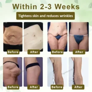 TightenLift™ SkinRenewal FirmingOil