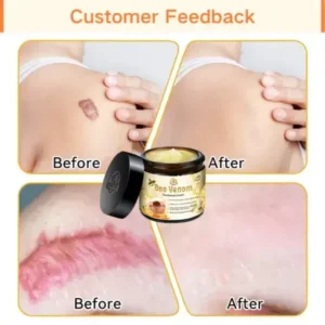 Turonu™ Bee Venom Treatment Cream