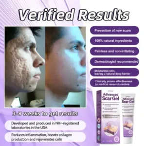 Zoencgz™ Advanced Scar Gel