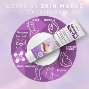 Zoencgz™ Advanced Scar Gel