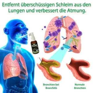 Ourlyard™ Eukalyptusöl Atemberuhigungsspray