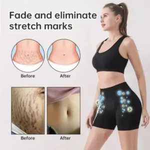 Paiduis™ Micro-Vibration Massage Module Ice Silk Ion Fiber Repair Shaping Shorts