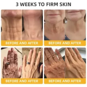 Bee Venom Retinol Skin Salve Ointment