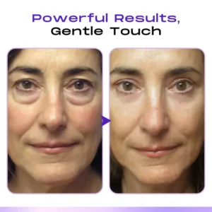 LOVILDS™ CollagenVen Bee Venom Eye Roller Serum-👨‍⚕️US Dermatologist Approved