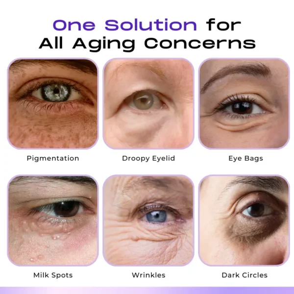 LOVILDS™ CollagenVen Bee Venom Eye Roller Serum-👨‍⚕️US Dermatologist Approved
