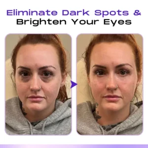 LOVILDS™ CollagenVen Bee Venom Eye Roller Serum-👨‍⚕️US Dermatologist Approved
