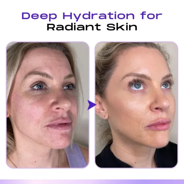 LOVILDS™ CollagenVen Bee Venom Eye Roller Serum-👨‍⚕️US Dermatologist Approved