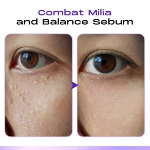LOVILDS™ CollagenVen Bee Venom Eye Roller Serum-👨‍⚕️US Dermatologist Approved