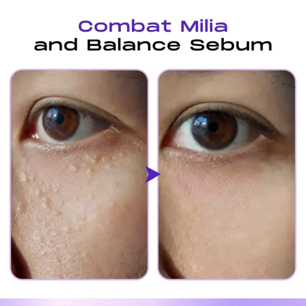LOVILDS™ CollagenVen Bee Venom Eye Roller Serum-👨‍⚕️US Dermatologist Approved