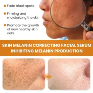KISSHI™ Melanin Correcting Facial Serum