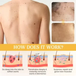 KISSHI™ NATURESTORE Instant Mole & Spot Cream