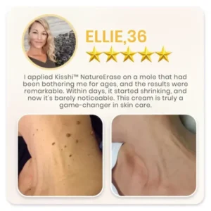 KISSHI™ NATURESTORE Instant Mole & Spot Cream