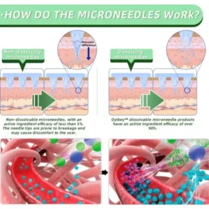 Oyikey™ SMGT-GLP-1 Nano Microneedle Patch