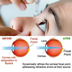 UNPREE™ Kolirin Eye Care Drops