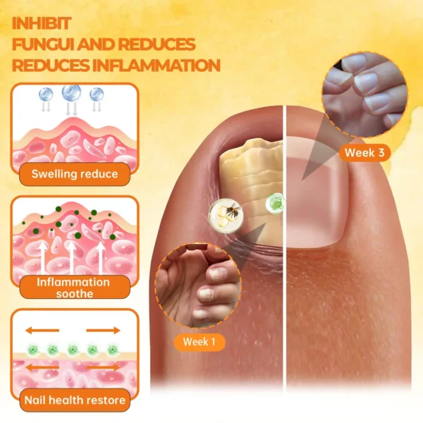 Cvreoz®Bee Venom Nail Renewal Spray👨‍⚕️ 𝘾𝙚𝙧𝙩𝙞𝙛𝙞𝙚𝙙 𝙗𝙮 𝙩𝙝𝙚 𝘼𝙢𝙚𝙧𝙞𝙘𝙖𝙣 𝘼𝙘𝙖𝙙𝙚𝙢𝙮 𝙤𝙛 𝘿𝙚𝙧𝙢𝙖𝙩𝙤𝙡𝙤𝙜𝙮(𝘼𝘼𝘿)