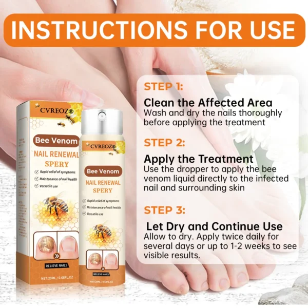 Cvreoz®Bee Venom Nail Renewal Spray👨‍⚕️ 𝘾𝙚𝙧𝙩𝙞𝙛𝙞𝙚𝙙 𝙗𝙮 𝙩𝙝𝙚 𝘼𝙢𝙚𝙧𝙞𝙘𝙖𝙣 𝘼𝙘𝙖𝙙𝙚𝙢𝙮 𝙤𝙛 𝘿𝙚𝙧𝙢𝙖𝙩𝙤𝙡𝙤𝙜𝙮(𝘼𝘼𝘿)