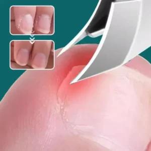 Multifunctional 25° Splash-proof Eagle-beak Oblique Nail Clippers