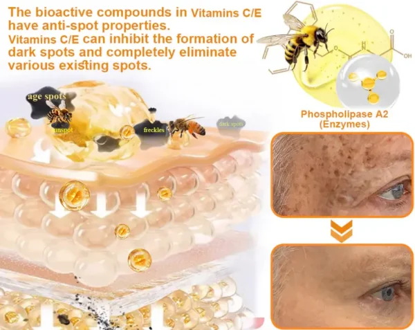 Ourlyard® Official Store: Bee Venom Skin Treatment Cream👨‍⚕️British Association of Dermatologists (BAD) Approved