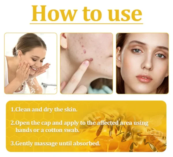 Ourlyard® Official Store: Bee Venom Skin Treatment Cream👨‍⚕️British Association of Dermatologists (BAD) Approved
