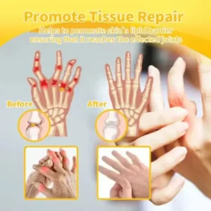 VENOLYX™ Bee Venom Rapid Therapy Joint Cream