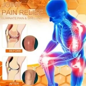 VENOLYX™ Bee Venom Rapid Therapy Joint Cream