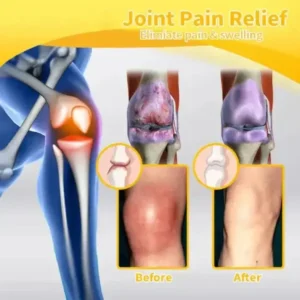 VENOLYX™ Bee Venom Rapid Therapy Joint Cream