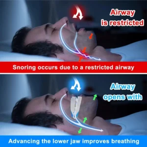 ZenSleep® – Say Goodbye to Snoring and Enjoy Peaceful Nights