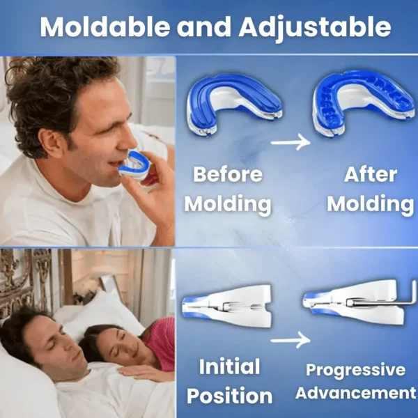 ZenSleep® – Say Goodbye to Snoring and Enjoy Peaceful Nights