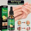 AQA™ - Ginger Nail Treatment Nail Support Nail Care👨‍⚕️