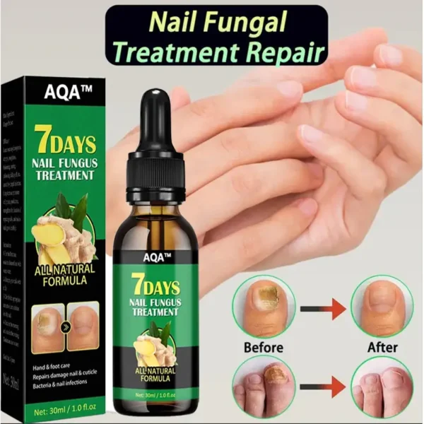 AQA™ - Ginger Nail Treatment Nail Support Nail Care👨‍⚕️