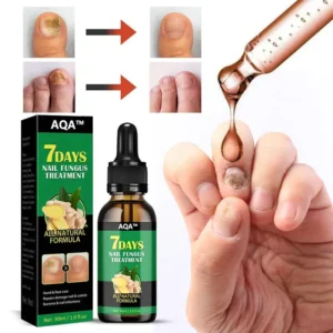 AQA™ - Ginger Nail Treatment Nail Support Nail Care👨‍⚕️