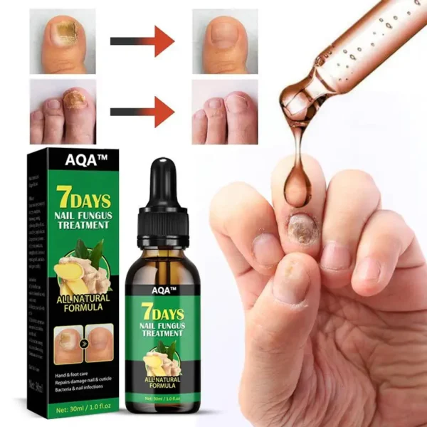 AQA™ - Ginger Nail Treatment Nail Support Nail Care👨‍⚕️