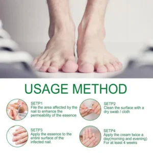 AQA™ - Ginger Nail Treatment Nail Support Nail Care👨‍⚕️