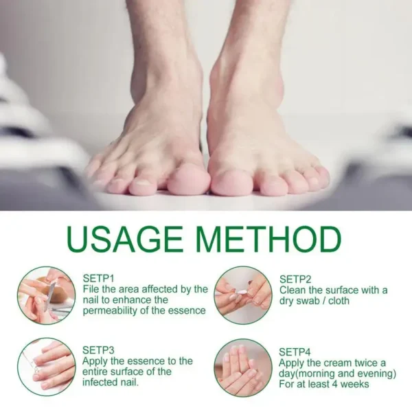 AQA™ - Ginger Nail Treatment Nail Support Nail Care👨‍⚕️