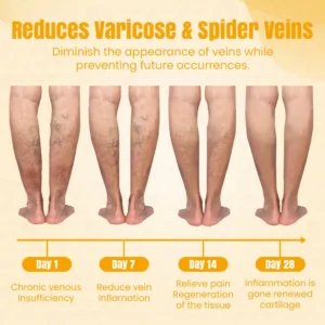 Ceoerty® VeinRelief Bee Venom Spray