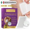 Cvreoz® Nanoparches de polidocanol para las varices