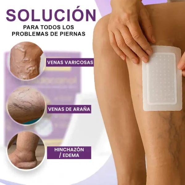 Cvreoz® Nanoparches de polidocanol para las varices