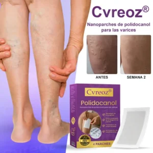 Cvreoz® Nanoparches de polidocanol para las varices