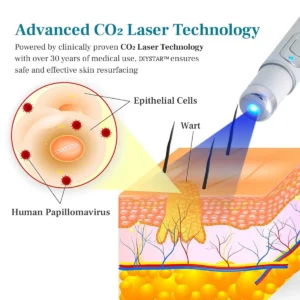 DIYSTAR™ LumeSkin Mole and Wart Removal Laser Pen