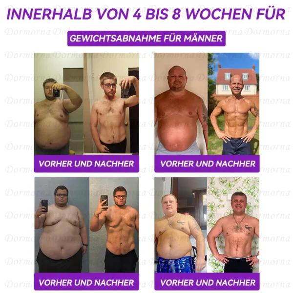 Empfohlen vom Universitätsklinikum Wien (UNIVIE) |Offizieller Laden | 𝐃𝐨𝐫𝐦𝐨𝐫𝐧𝐚® 🍪𝐆𝐋𝐏-𝟏 𝐎𝐫𝐚𝐥𝐞 𝐅𝐥ü𝐬𝐬𝐢𝐠𝐤𝐞𝐢𝐭--✅Revolutionäre wissenschaftliche GLP-1-Programme zur Zuckerkontrolle und Gewichtsabnahme