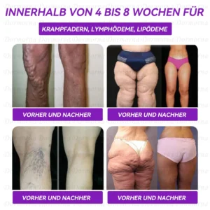 Empfohlen vom Universitätsklinikum Wien (UNIVIE) |Offizieller Laden | 𝐃𝐨𝐫𝐦𝐨𝐫𝐧𝐚® 🍪𝐆𝐋𝐏-𝟏 𝐎𝐫𝐚𝐥𝐞 𝐅𝐥ü𝐬𝐬𝐢𝐠𝐤𝐞𝐢𝐭--✅Revolutionäre wissenschaftliche GLP-1-Programme zur Zuckerkontrolle und Gewichtsabnahme