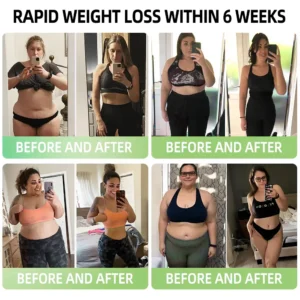 Glowrizon™ 👩‍⚕️GLP-1 Miracle Tree Extract Weight Loss Health Capsules