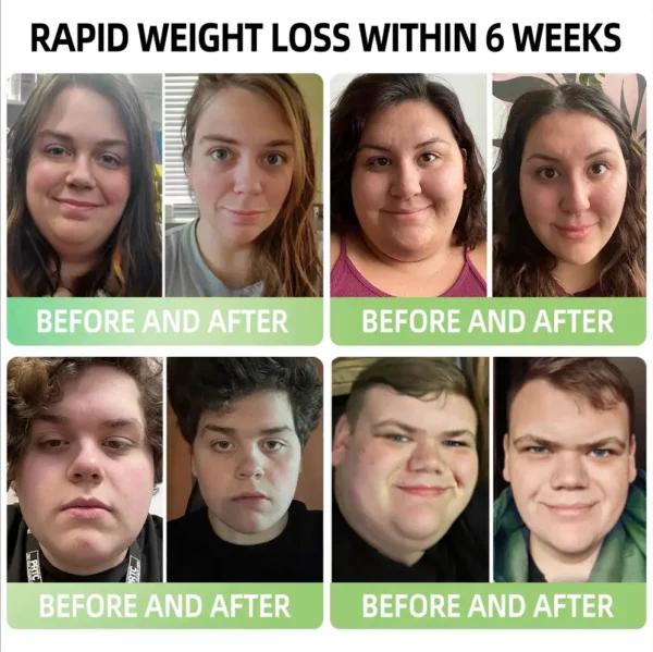 Glowrizon™ 👩‍⚕️GLP-1 Miracle Tree Extract Weight Loss Health Capsules