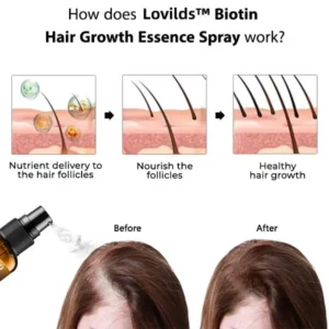 （🔥LAST DAY SALE-80% OFF) Lovilds™ Biotin Premium Hair Growth Serum