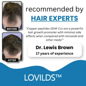LOVILDS™ Clinically Backed Hair Regrowth Formula Trusted by Experts