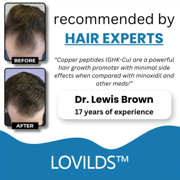 LOVILDS™ Clinically Backed Hair Regrowth Formula Trusted by Experts