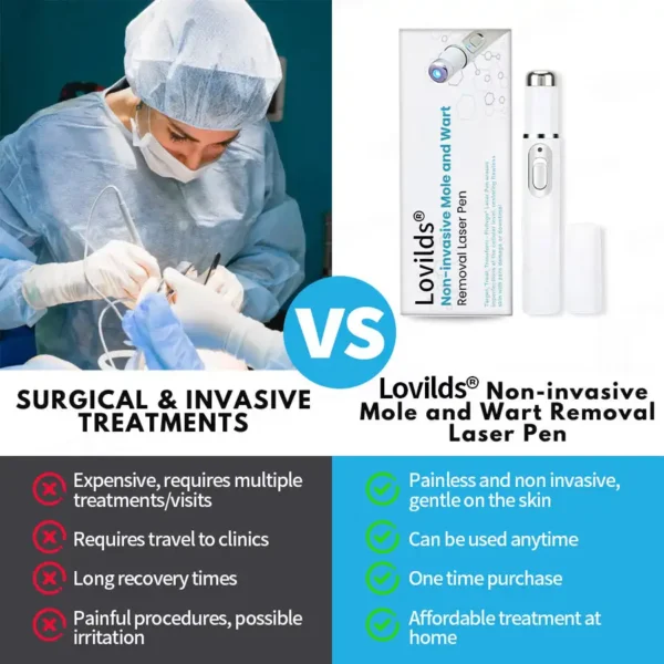 Lovilds® Non-Invasive Mole and Wart Removal Laser Pen